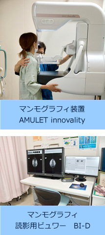 「マンモグラフィ装置 AMULET innovality」と「マンモグラフィ 読影用ビュワ BI-D」